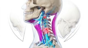교통사고 편타성 손상 기전의 의학적 3D 일러스트